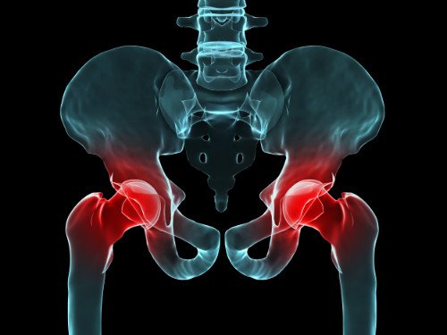 Hip Pain and Injuries