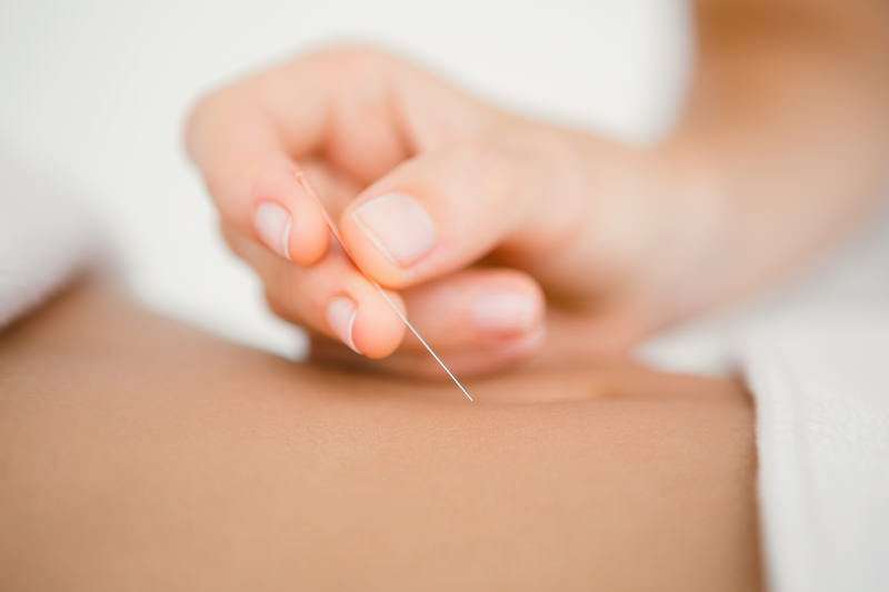 Acupuncture Treatment in San Jose CA