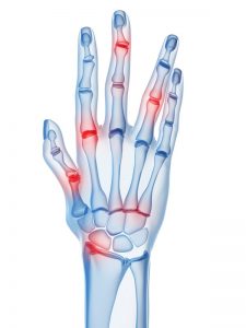 xray of the hand