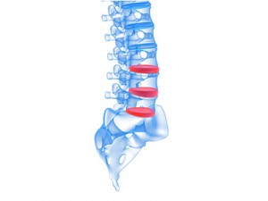 graphics showing the spine model