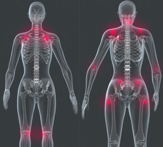  graphics showing joint pain