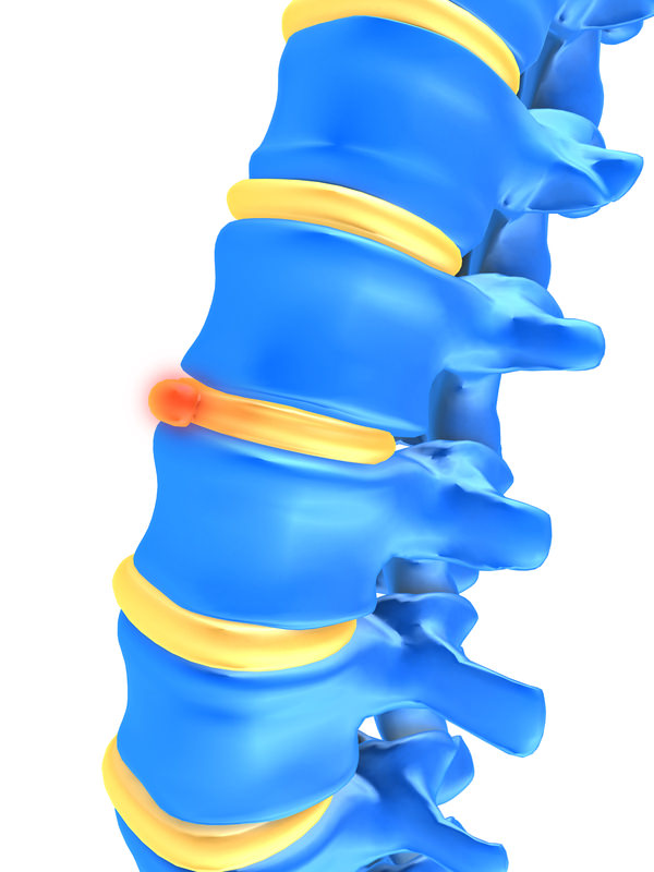 X-ray of the spine