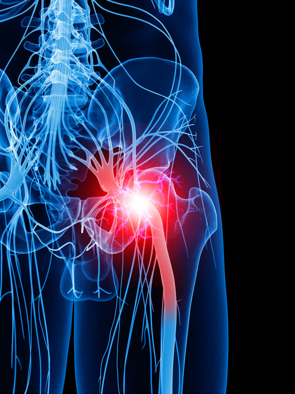 Sciatica  Back and Neck Clinic Sapulpa