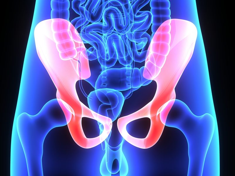 graphics showing pelvic x-rays