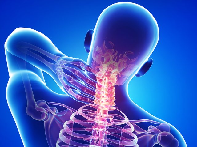 graphics depicting neck pain