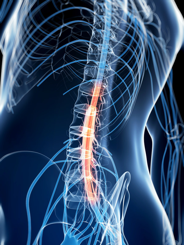 x-ray of human spine with spinal cord stimulation displayed