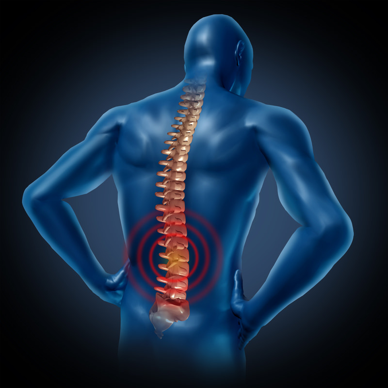 picutre of a human upper body with x-rayed spine and highlighted area of thoracic radiculopathy