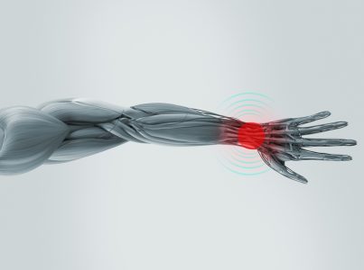 a picture of a person's arm muscles with a highlighted wrist