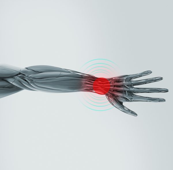 graphics depicting wrist pain