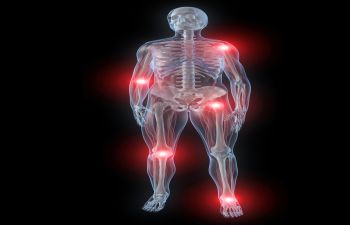 Joint Pain Relief San Jose CA
